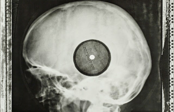 Soviet-Era Banned Western Music Pressed onto X-Rays